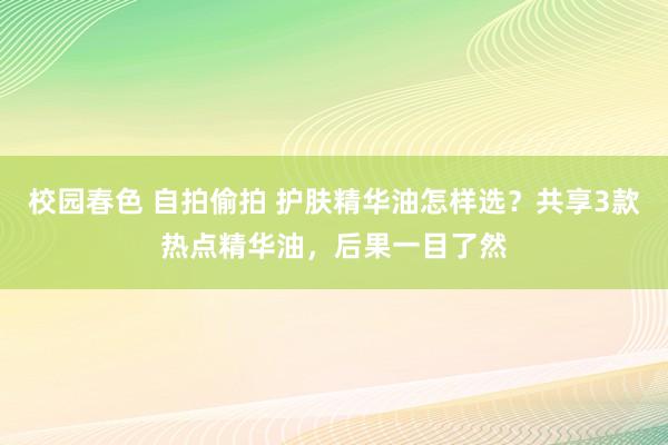 校园春色 自拍偷拍 护肤精华油怎样选？共享3款热点精华油，后果一目了然